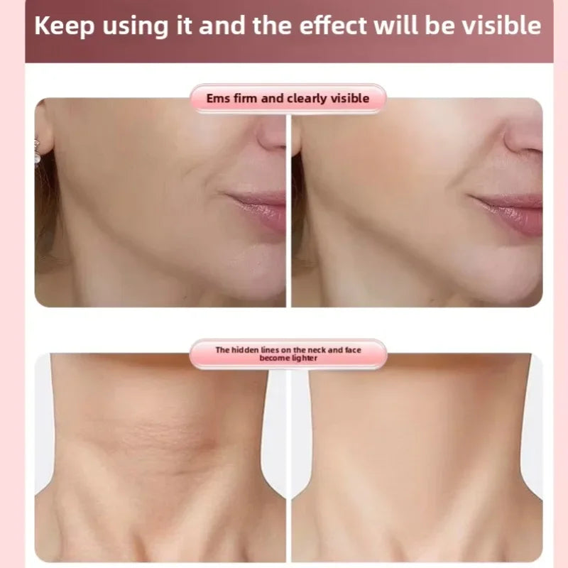 V-Lift Beauty Roller