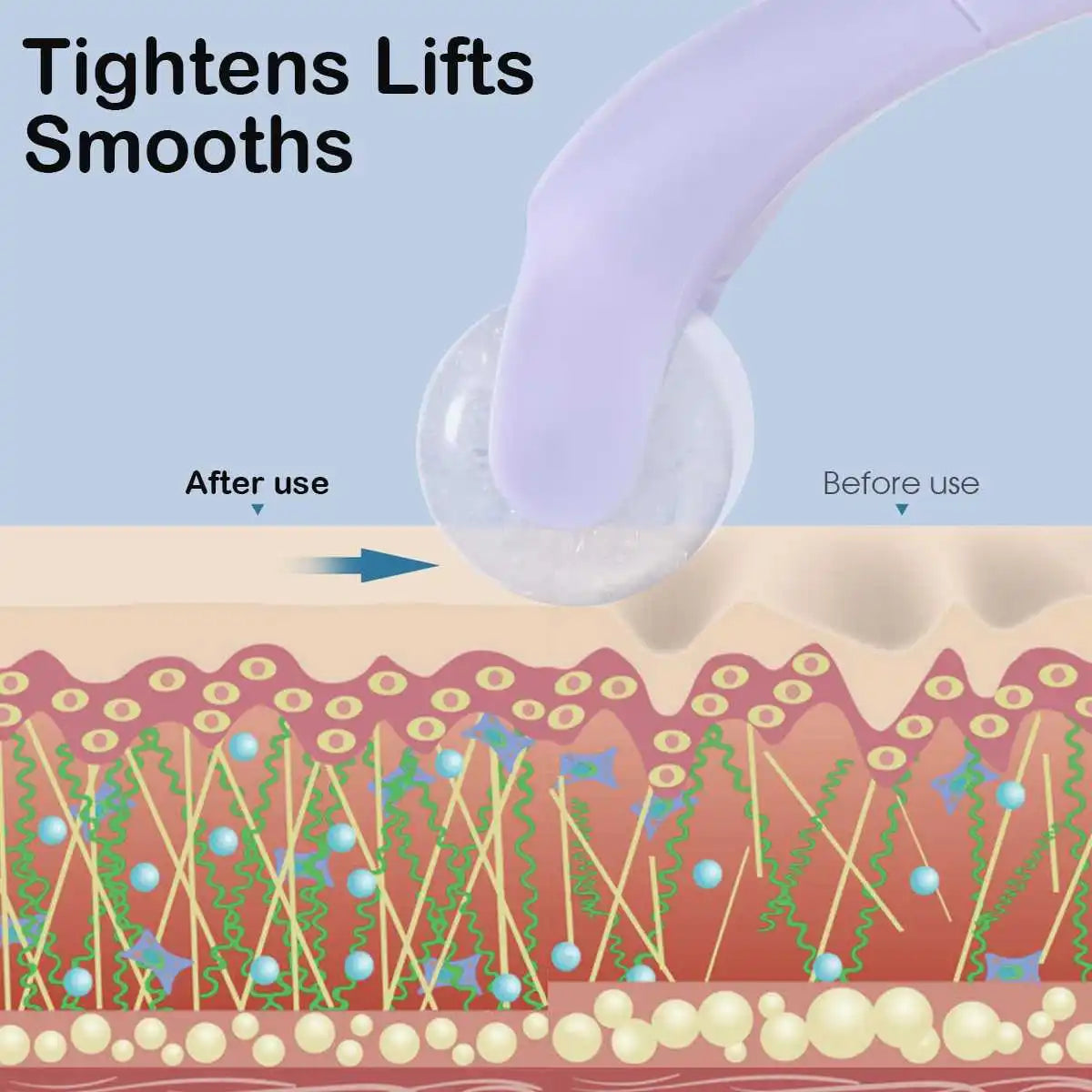 Ice Compress Microneedle Roller