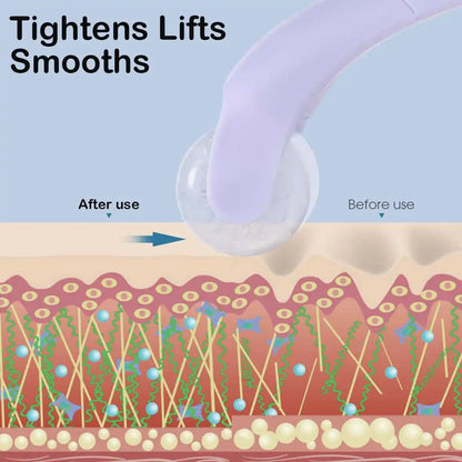 Ice Compress Microneedle Roller