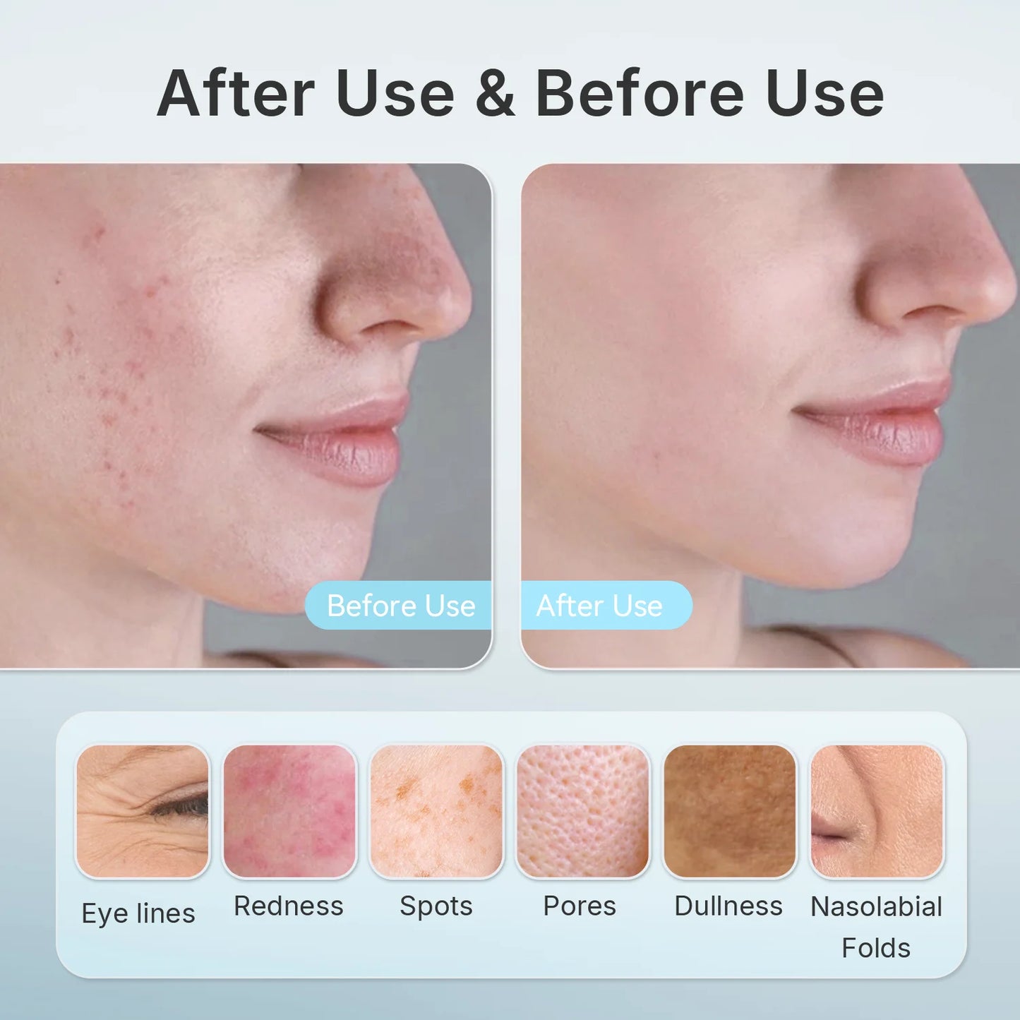 High-Fit Face Photon Mask
